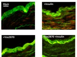 Nuevo enfoque para tratar el daño vascular que ocasiona la insulina en diabéticos Imágenes teñidas de producción de oxígeno (rojo) en respuesta al tratamiento con insulina en el tejido de los vasos sanguíneos