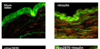 Nuevo enfoque para tratar el daño vascular que ocasiona la insulina en diabéticos Imágenes teñidas de producción de oxígeno (rojo) en respuesta al tratamiento con insulina en el tejido de los vasos sanguíneos