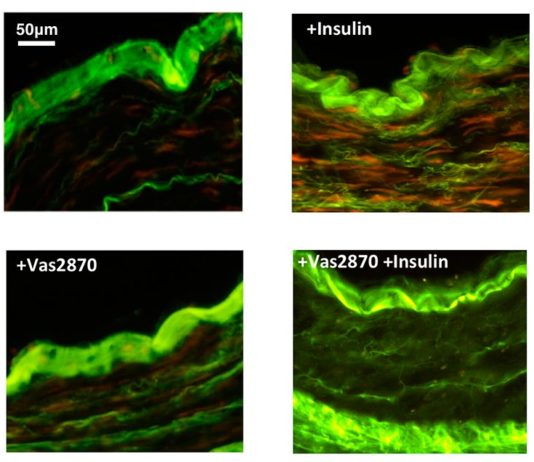 Nuevo enfoque para tratar el daño vascular que ocasiona la insulina en diabéticos Imágenes teñidas de producción de oxígeno (rojo) en respuesta al tratamiento con insulina en el tejido de los vasos sanguíneos