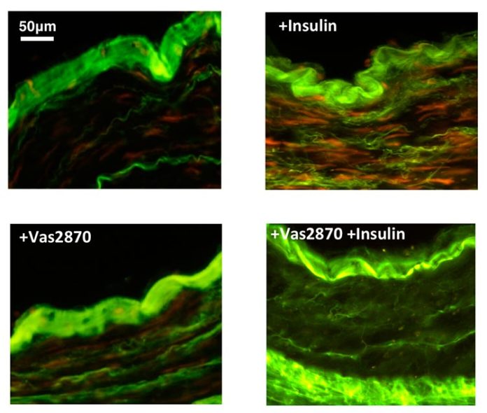 Imágenes teñidas de producción de oxígeno (rojo) en respuesta al tratamiento con insulina en el tejido de los vasos sanguíneos Imágenes teñidas de producción de oxígeno (rojo) en respuesta al tratamiento con insulina en el tejido de los vasos sanguíneos
