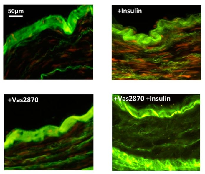 Imágenes teñidas de producción de oxígeno (rojo) en respuesta al tratamiento con insulina en el tejido de los vasos sanguíneos