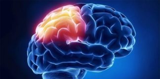 Un estudio muestra cómo se podría preservar la memoria después de una lesión cerebral Lesión cerebral