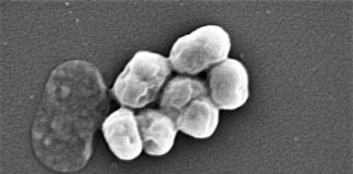La rifabutina, un antibiótico viejo, parece efectivo contra una de las más peligrosas superbacterias Acinetobacter baumannii