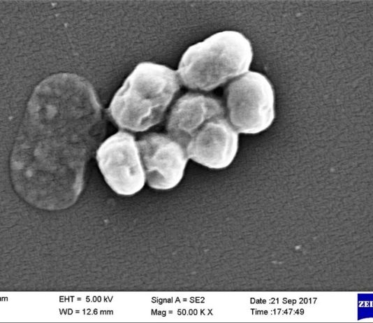 La rifabutina, un antibiótico viejo, parece efectivo contra una de las más peligrosas superbacterias Acinetobacter baumannii