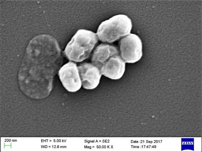 Acinetobacter baumannii Acinetobacter baumannii