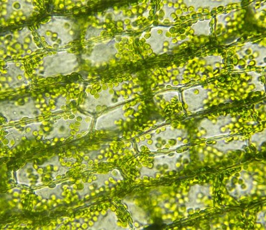 ¿Cómo responden las plantas a un aguacero?: ¿Inducen la muerte celular? Células vegetales