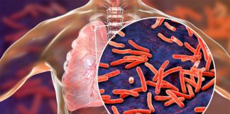 Varios compuestos candidatos a antibióticos son prometedores contra la tuberculosis Tuberculosis