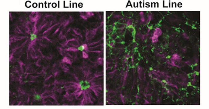 Formación de rosetas neurales en líneas de células madre de control versus autismo. Crédito: Biological Psychiatry
