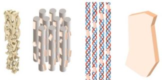 El riesgo de fractura de cadera vinculado a la inflexibilidad ósea a nanoescala Osteoporosis: Cómo los minerales rígidos y las fibrillas de colágeno flexibles se combinan a nanoescala para formar hueso