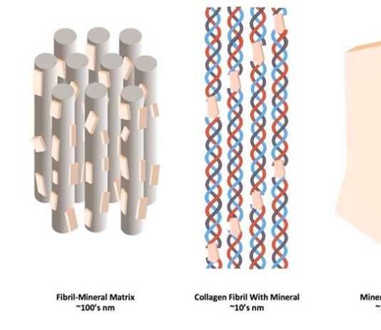 El riesgo de fractura de cadera vinculado a la inflexibilidad ósea a nanoescala Osteoporosis: Cómo los minerales rígidos y las fibrillas de colágeno flexibles se combinan a nanoescala para formar hueso