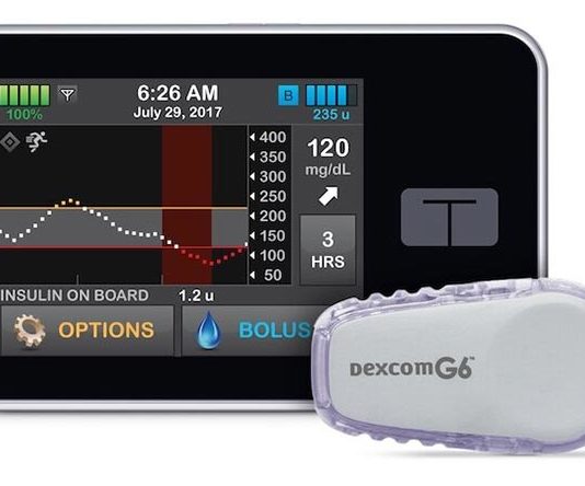 Páncreas artificial eficaz para niños de 6 a 13 años con diabetes tipo I Sistema de páncreas artificial Control-IQ