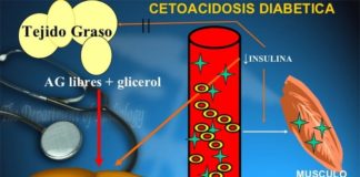 Diabetes: Un episodio grave de cetoacidosis diabética puede dañar la memoria Cetoacidosis diabética