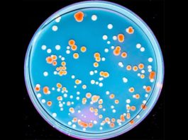 ¿Cómo resisten algunos organismos extremófilos la radiación? Respuestas E. coli radiorresistente inducida desarrolla perfiles de mutación complejos a medida que continúa la evolución experimental y aumenta el nivel de radiorresistencia