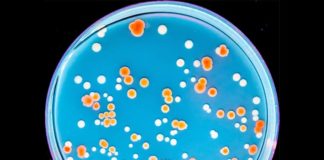 ¿Cómo resisten algunos organismos extremófilos la radiación? Respuestas E. coli radiorresistente inducida desarrolla perfiles de mutación complejos a medida que continúa la evolución experimental y aumenta el nivel de radiorresistencia