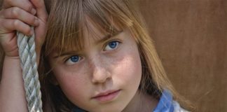 Oftalmólogos advierten que el sol y el cloro pueden provocar lesiones en los ojos Niña