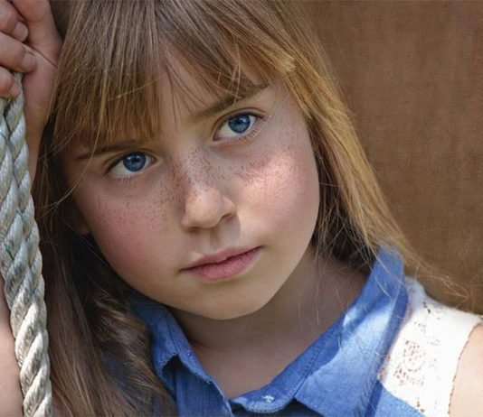 Oftalmólogos advierten que el sol y el cloro pueden provocar lesiones en los ojos Niña