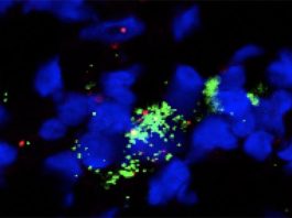 El fármaco plerixafor parece ayudar a combatir cánceres de difícil tratamiento Con administración de plerixafor, identificada una sola célula reticular fibroblástica, al teñirla: el núcleo celular (azul), los marcadores que identifican los fibroblastos (rojo) y una molécula que atrae las células inmunes (verde)