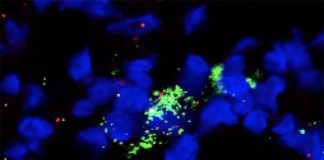 El fármaco plerixafor parece ayudar a combatir cánceres de difícil tratamiento Con administración de plerixafor, identificada una sola célula reticular fibroblástica, al teñirla: el núcleo celular (azul), los marcadores que identifican los fibroblastos (rojo) y una molécula que atrae las células inmunes (verde)