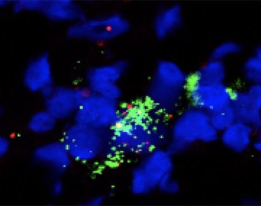 El fármaco plerixafor parece ayudar a combatir cánceres de difícil tratamiento Con administración de plerixafor, identificada una sola célula reticular fibroblástica, al teñirla: el núcleo celular (azul), los marcadores que identifican los fibroblastos (rojo) y una molécula que atrae las células inmunes (verde)