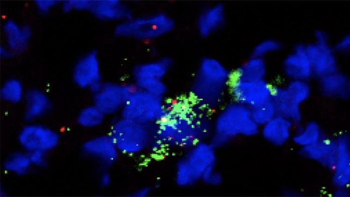 Con administración de plerixafor, identificada una sola célula reticular fibroblástica, al teñirla: el núcleo celular (azul), los marcadores que identifican los fibroblastos (rojo) y una molécula que atrae las células inmunes (verde) Con administración de plerixafor, identificada una sola célula reticular fibroblástica, al teñirla: el núcleo celular (azul), los marcadores que identifican los fibroblastos (rojo) y una molécula que atrae las células inmunes (verde)
