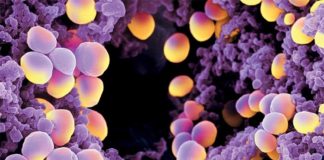 Diabetes: El secreto de la virulencia de las superbacterias en las infecciones Diabetes: Staphylococcus aureus, que causa virulentas infecciones