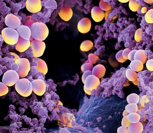 Diabetes: El secreto de la virulencia de las superbacterias en las infecciones Diabetes: Staphylococcus aureus, que causa virulentas infecciones