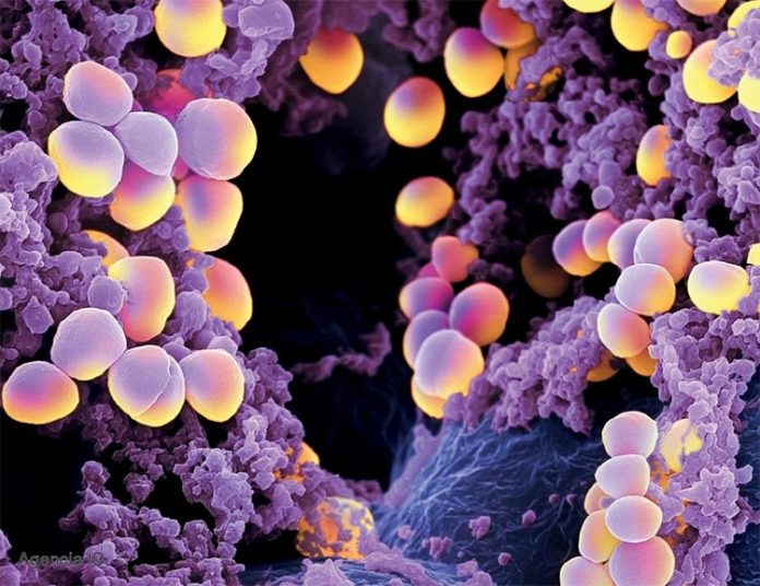 Diabetes: Staphylococcus aureus, que causa virulentas infecciones