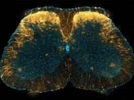 Nuevo mecanismo de control del dolor: astrocitos de la médula espinal Marcada con amarillo concentrado en la imagen, se ha descubierto que una población única de astrocitos en el cuerno dorsal de la médula espinal del ratón juega un papel en el control del dolor