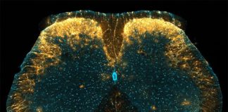 Nuevo mecanismo de control del dolor: astrocitos de la médula espinal Marcada con amarillo concentrado en la imagen, se ha descubierto que una población única de astrocitos en el cuerno dorsal de la médula espinal del ratón juega un papel en el control del dolor