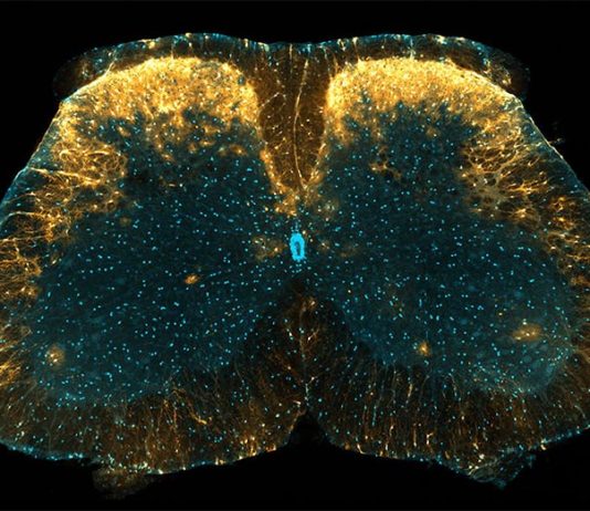 Nuevo mecanismo de control del dolor: astrocitos de la médula espinal Marcada con amarillo concentrado en la imagen, se ha descubierto que una población única de astrocitos en el cuerno dorsal de la médula espinal del ratón juega un papel en el control del dolor