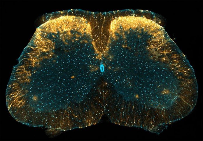 Marcada con amarillo concentrado en la imagen, se ha descubierto que una población única de astrocitos en el cuerno dorsal de la médula espinal del ratón juega un papel en el control del dolor