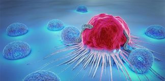 Las células tumorales crean depósitos de ribosomas que les permiten sobrevivir en condiciones adversas Cáncer: migración de células cancerosas