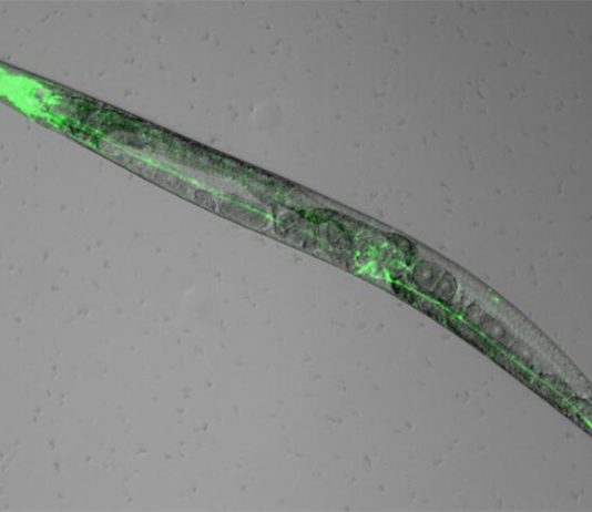 Los gusanos revelan por qué la melatonina promueve el sueño Las neuronas del gusano Caennorhabditis elegans que expresan el receptor de melatonina brillan en verde