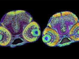 Descubren un nuevo mecanismo que controla el tamaño de la corteza cerebral La imagen muestra el cerebro de una larva normal de pez cebra (izquierda) y una larva con microcefalia (derecha)