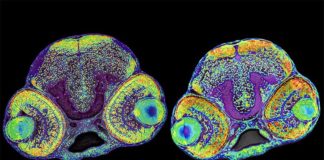 Descubren un nuevo mecanismo que controla el tamaño de la corteza cerebral La imagen muestra el cerebro de una larva normal de pez cebra (izquierda) y una larva con microcefalia (derecha)