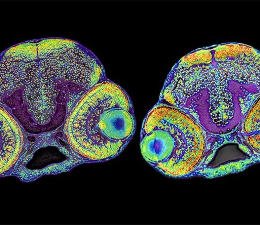 Descubren un nuevo mecanismo que controla el tamaño de la corteza cerebral La imagen muestra el cerebro de una larva normal de pez cebra (izquierda) y una larva con microcefalia (derecha)