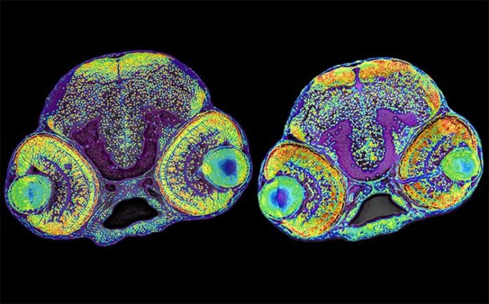 La imagen muestra el cerebro de una larva normal de pez cebra (izquierda) y una larva con microcefalia (derecha)