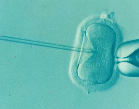 La fecundación in vitro no parece aumentar el riesgo de cáncer de ovario Fecundación in vitro