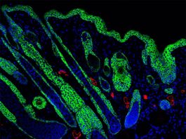 Un biomaterial curativo de heridas activa el sistema inmunológico para una piel más fuerte Folículos pilosos regenerados en el centro de una herida gracias al biomaterial curativo