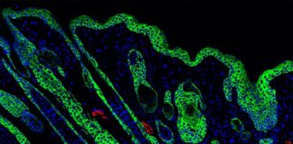 Un biomaterial curativo de heridas activa el sistema inmunológico para una piel más fuerte Folículos pilosos regenerados en el centro de una herida gracias al biomaterial curativo