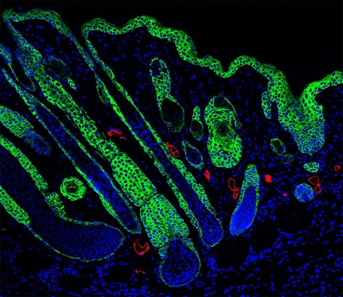 Folículos pilosos regenerados en el centro de una herida gracias al biomaterial curativo Folículos pilosos regenerados en el centro de una herida gracias al biomaterial curativo