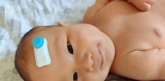 Desarrollan un pequeño sensor de oxigenación cerebral para bebés prematuros Philip, con el sensor para bebés prematuros que mide la oxigenación cerebral