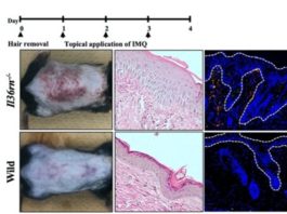 Psoriasis y el sistema inmune: una nueva investigación podría conducir a una terapia Investigación sobre la psoriasis en ratones
