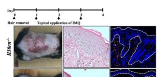 Psoriasis y el sistema inmune: una nueva investigación podría conducir a una terapia Investigación sobre la psoriasis en ratones