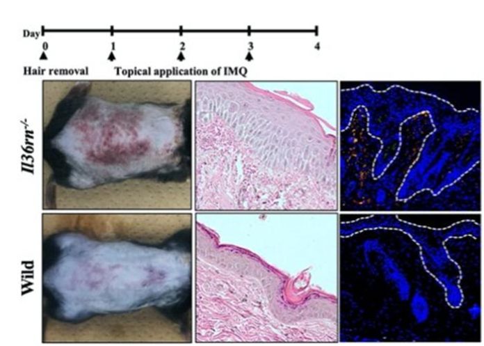 Investigación sobre la psoriasis en ratones