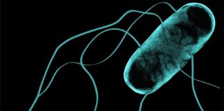 Cómo la Salmonella africana dio el salto del intestino al torrente sanguíneo Imagen de microscopio electrónico de la Salmonella africana