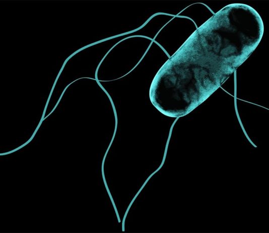 Cómo la Salmonella africana dio el salto del intestino al torrente sanguíneo Imagen de microscopio electrónico de la Salmonella africana