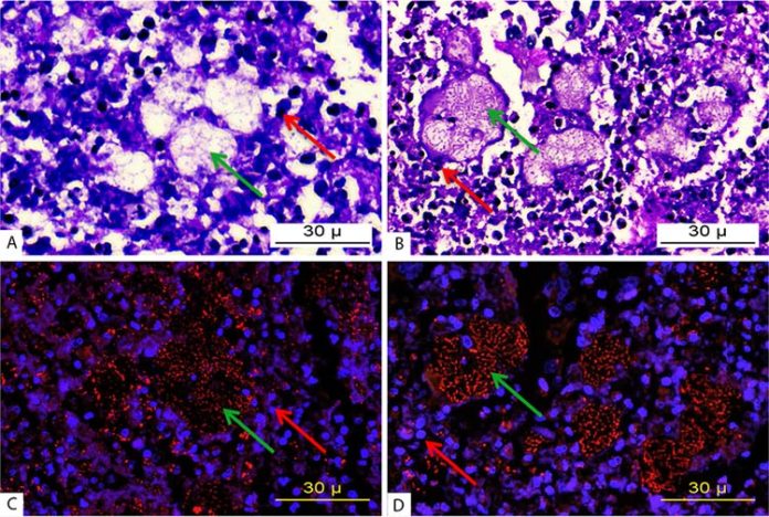 Micrografía de tejido pulmonar infectado por P. aeruginosa Micrografía de tejido pulmonar infectado por P. aeruginosa