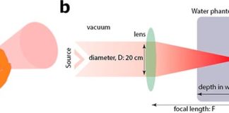 Estudio experimental: La radioterapia de alta energía podría matar tumores y evitar el tejido sano Radioterapia centrada en VHEE