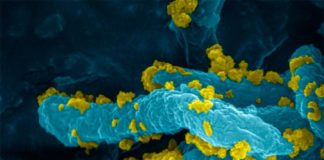 Producen hidrógeno a partir de la luz con bacterias no fotosintéticas Los híbridos de Desulfovibrio desulfuricans-CdS muestran una alta actividad de producción de hidrógeno (H2), una alta estabilidad y una notable eficiencia en el uso directo de la energía solar